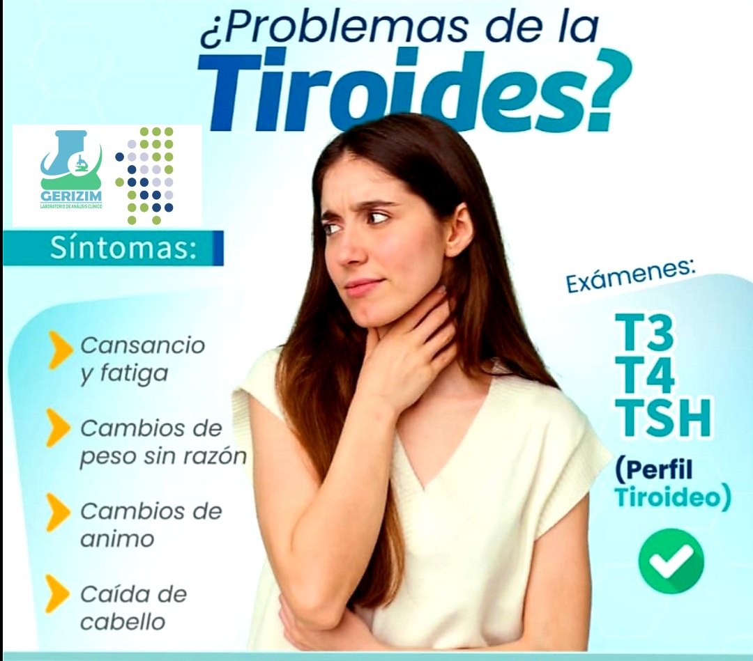 Hormonas tiroideas
